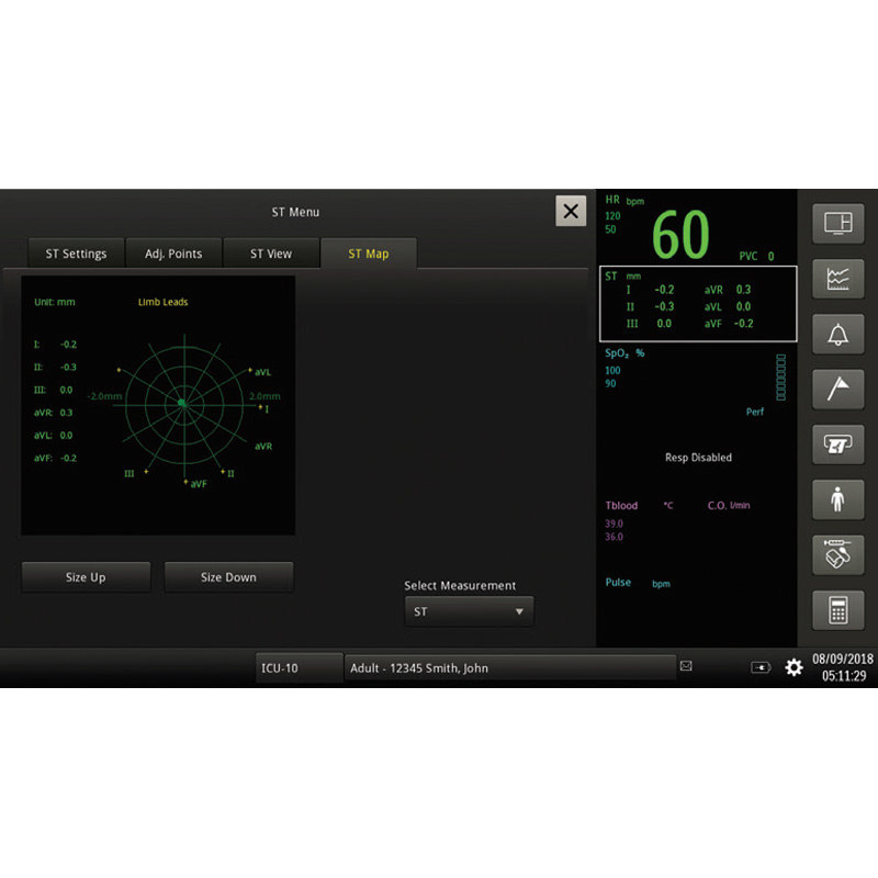 Монитор пациента Philips Efficia CM12